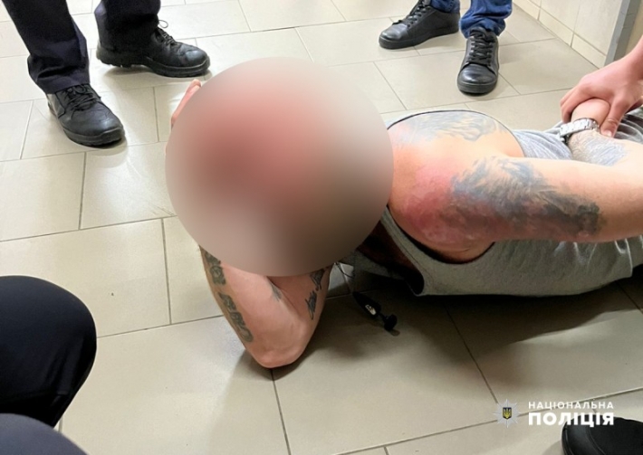 У Чернівцях мешканець Запорізької області прийшов до лікарні з гранатою