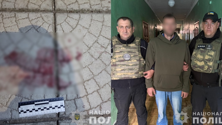 Чоловік отримав ножове поранення під час сварки: поліція розслідує інцидент в Запоріжжі